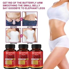 Fat Burner for Women 12,000 mg, Appetite Control, Weight Loss, 120 Capsules