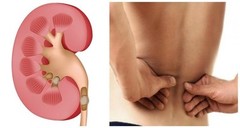Kidney Flush – KIDNEY SUPPORT – Bladder Health – Kidney Boost – 3 B 180 Ct