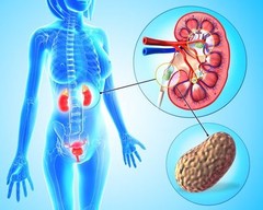 Kidney Health – KIDNEY SUPPORT – Bladder Health – Kidney Boost – 3 B 180 Ct