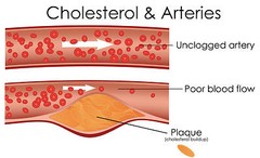 Lower Cholesterol – NEW CHOLESTEROL RELIEF FORMULA – lowers LDL – 1 Bottle
